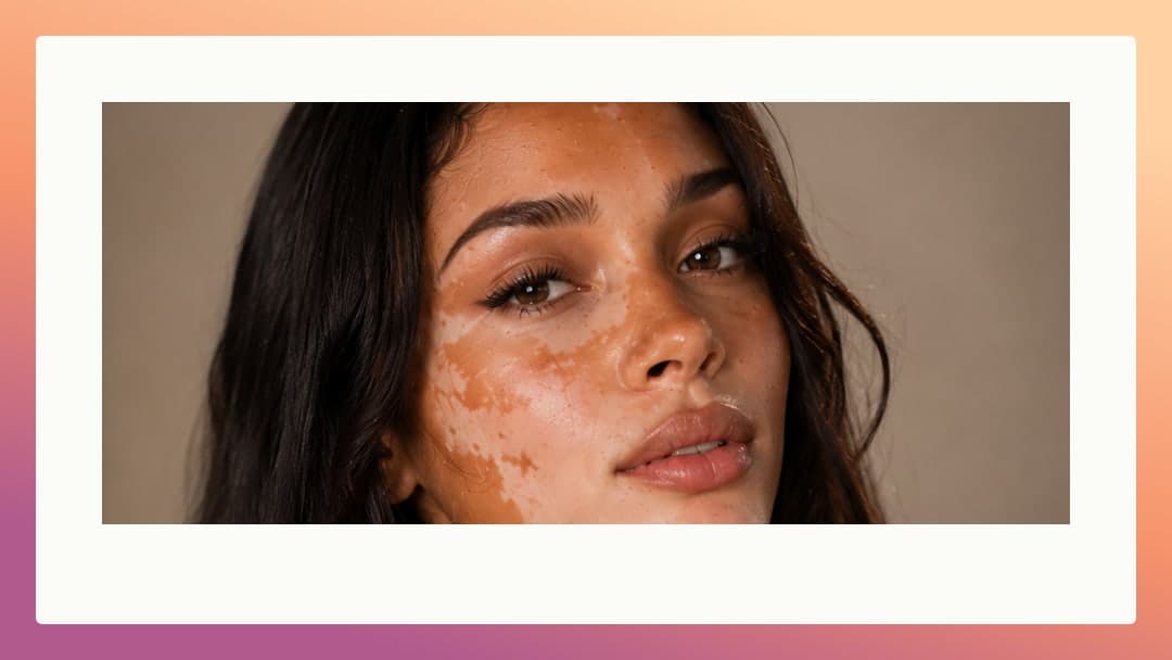 Studio close-up vitiligo face portrait