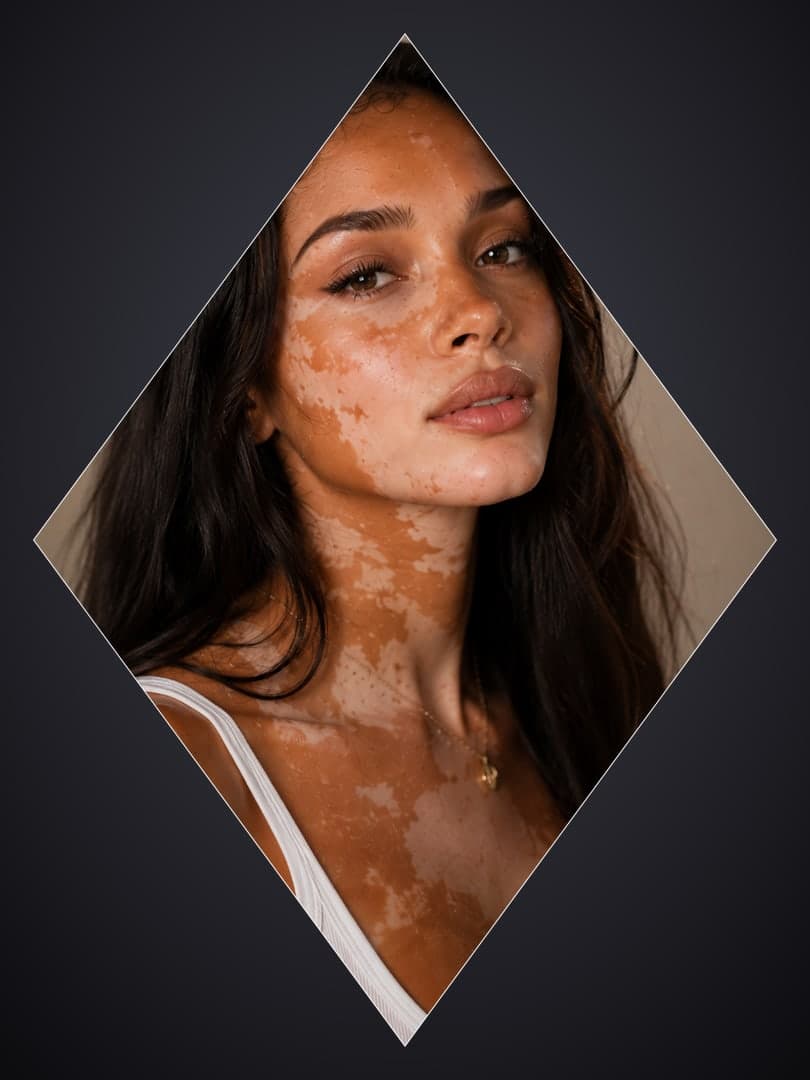Vitiligo skin close-up portrait